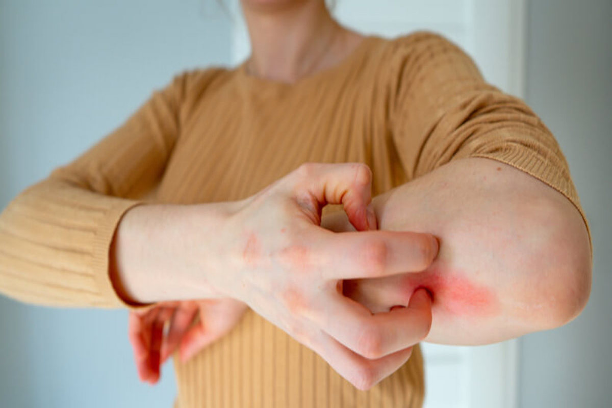 7 Most Common Skin Rashes in the United States